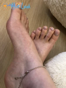 11520576