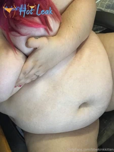 11935539