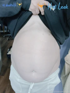 11802994