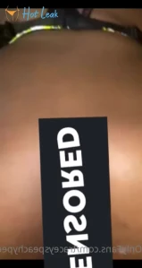 11018779