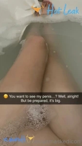 11877418