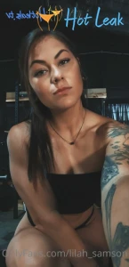11820559