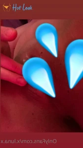 11251831