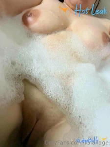 11613379