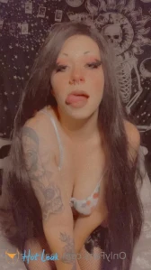 11351881