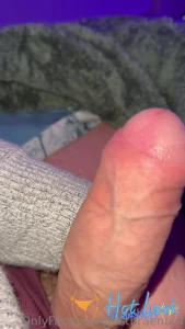11795178