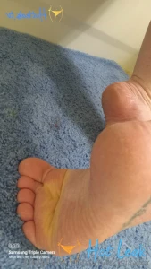 11625805