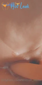 11863396