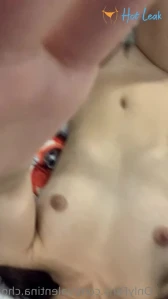11354612
