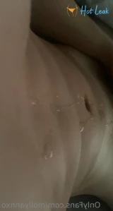 11280620