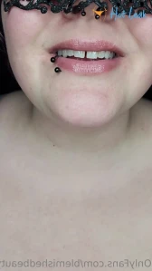 11350610
