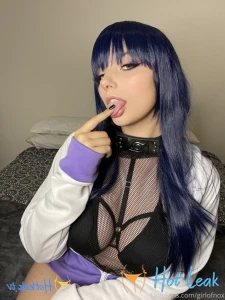 11872177