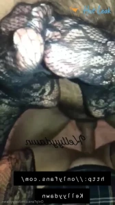 11352332