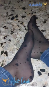 11635387