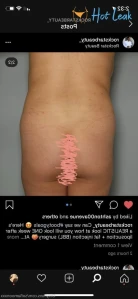 4624944