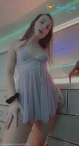 11359217