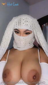 11361665