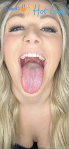 11818294