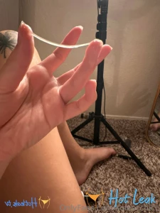11632864