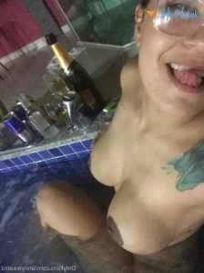 11378953