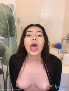 11403994