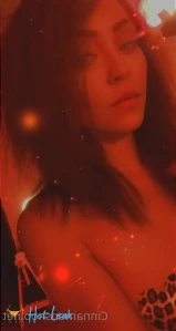 11412418