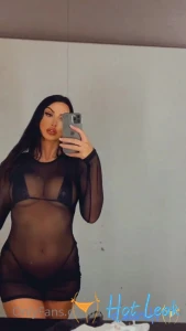 11915522