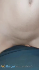 9318633