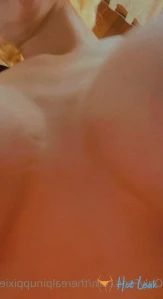 7784476